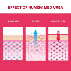 numis med UREA 10% Fusscreme, 100 ml