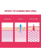 numis med UREA 10% Fusscreme, 100 ml