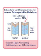 sanosan Dehnungsstreifen Minimierer, 75 ml