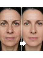 Gold SilkPeptide Lift, 30 ml