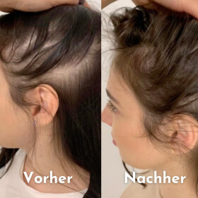 Hairfect Ansatzpuder (Dunkelbraun)