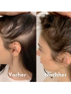 Hairfect Ansatzpuder (Dunkelbraun)