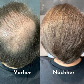 Hairfect Ansatzpuder (Hellbraun)