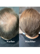 Hairfect Ansatzpuder (Hellbraun)