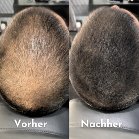 Hairfect Ansatzpuder (Schwarz)
